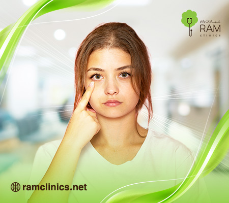 احمرار العين