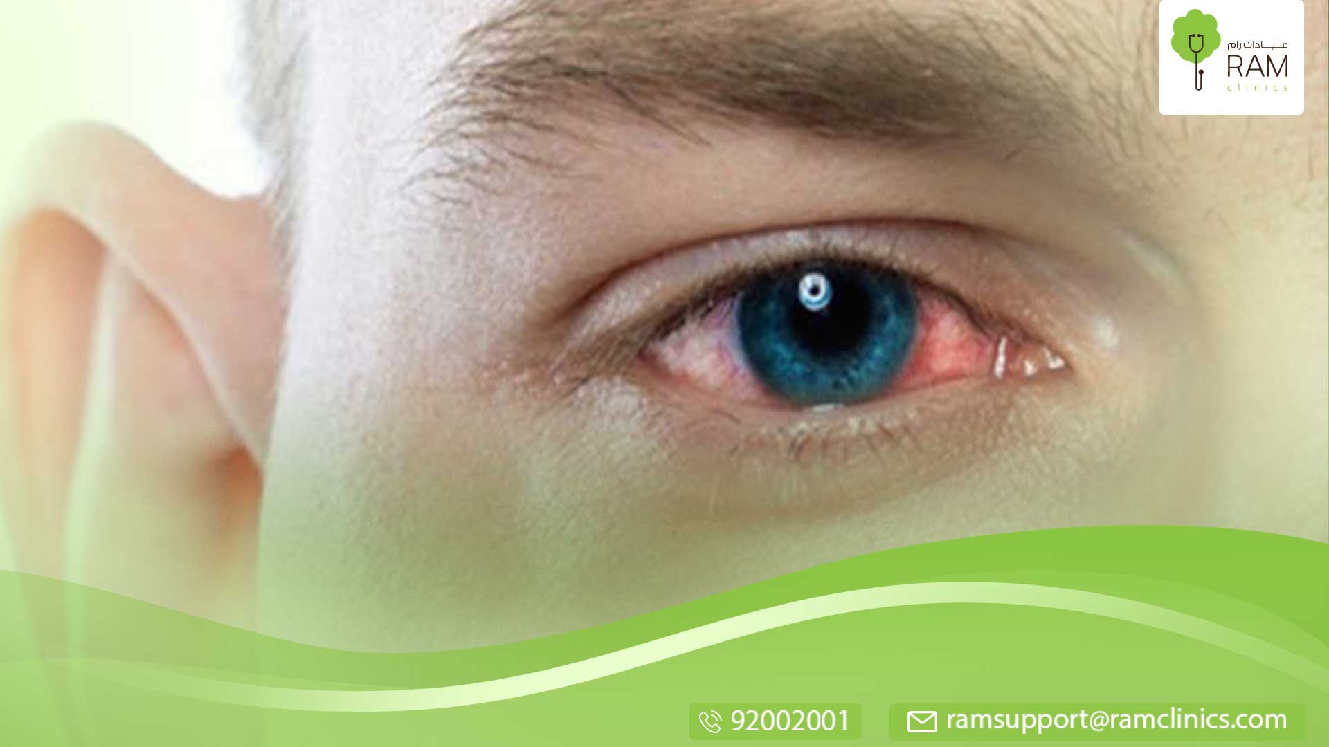 اسباب التهاب العين