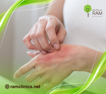 الحكة المزعجة