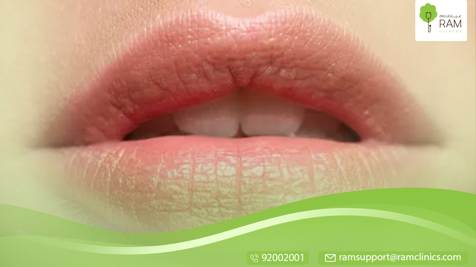 الوصفات الطبيعية لتفتيح الشفايف