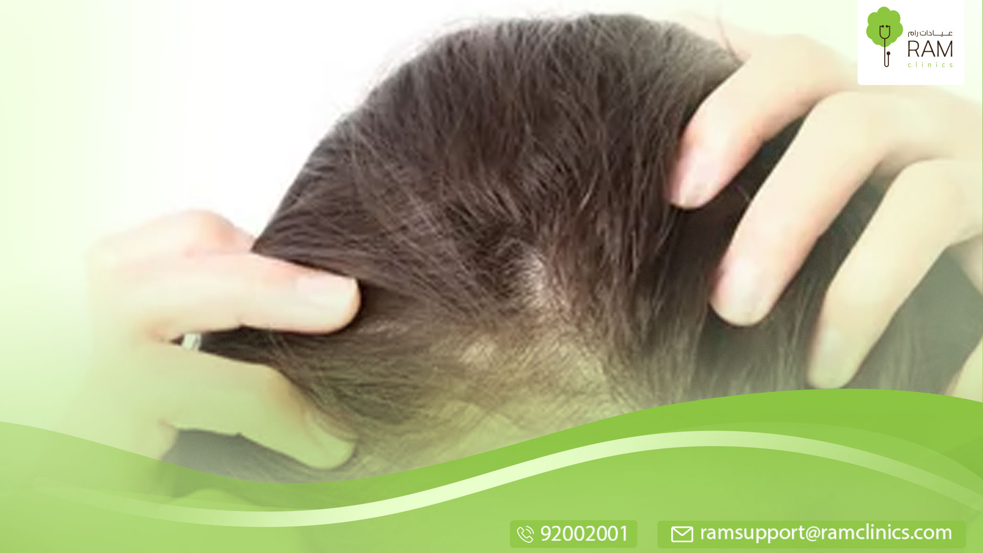 إنبات فراغات الشعر