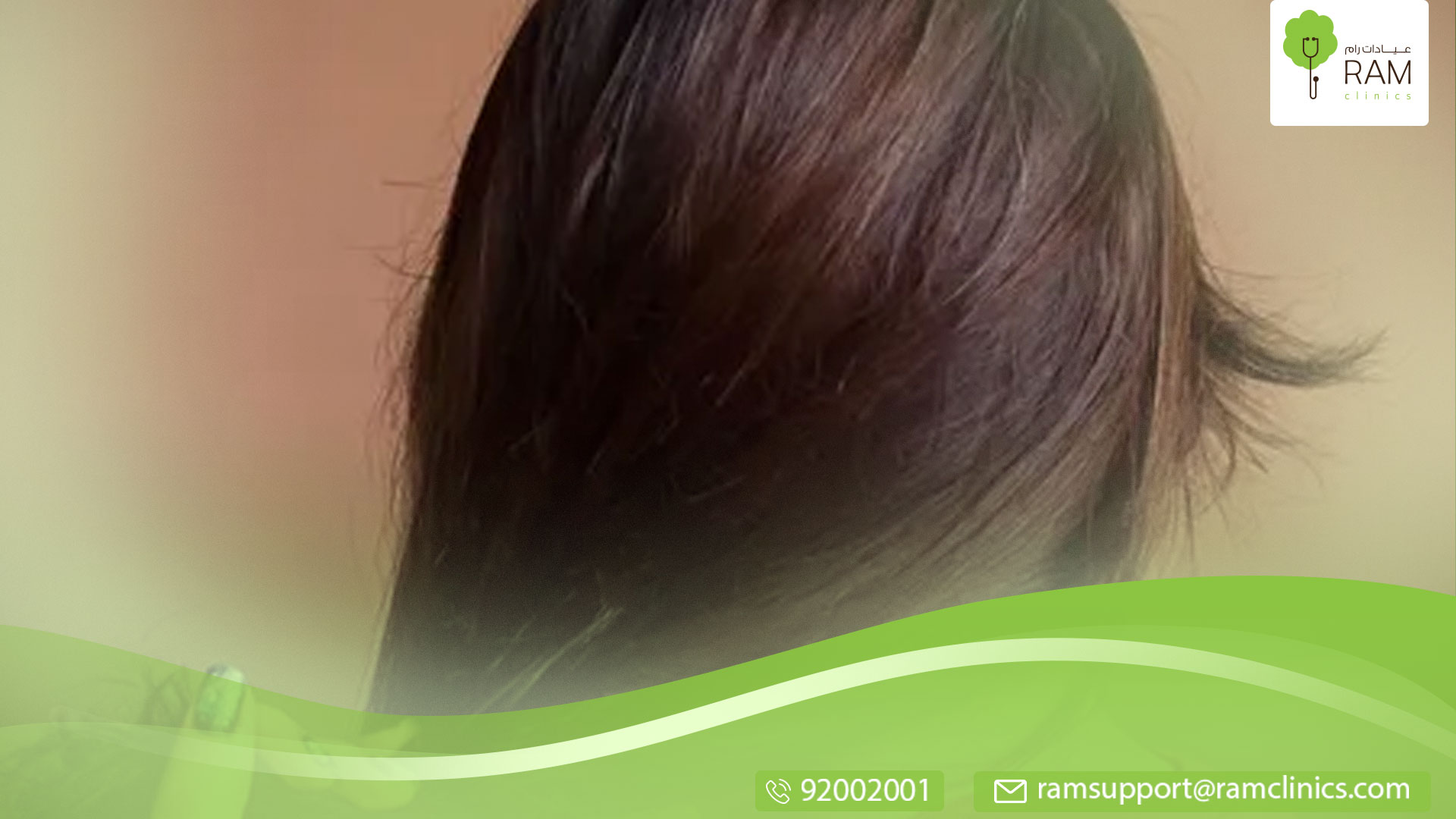 وصفات للشعر المحروق