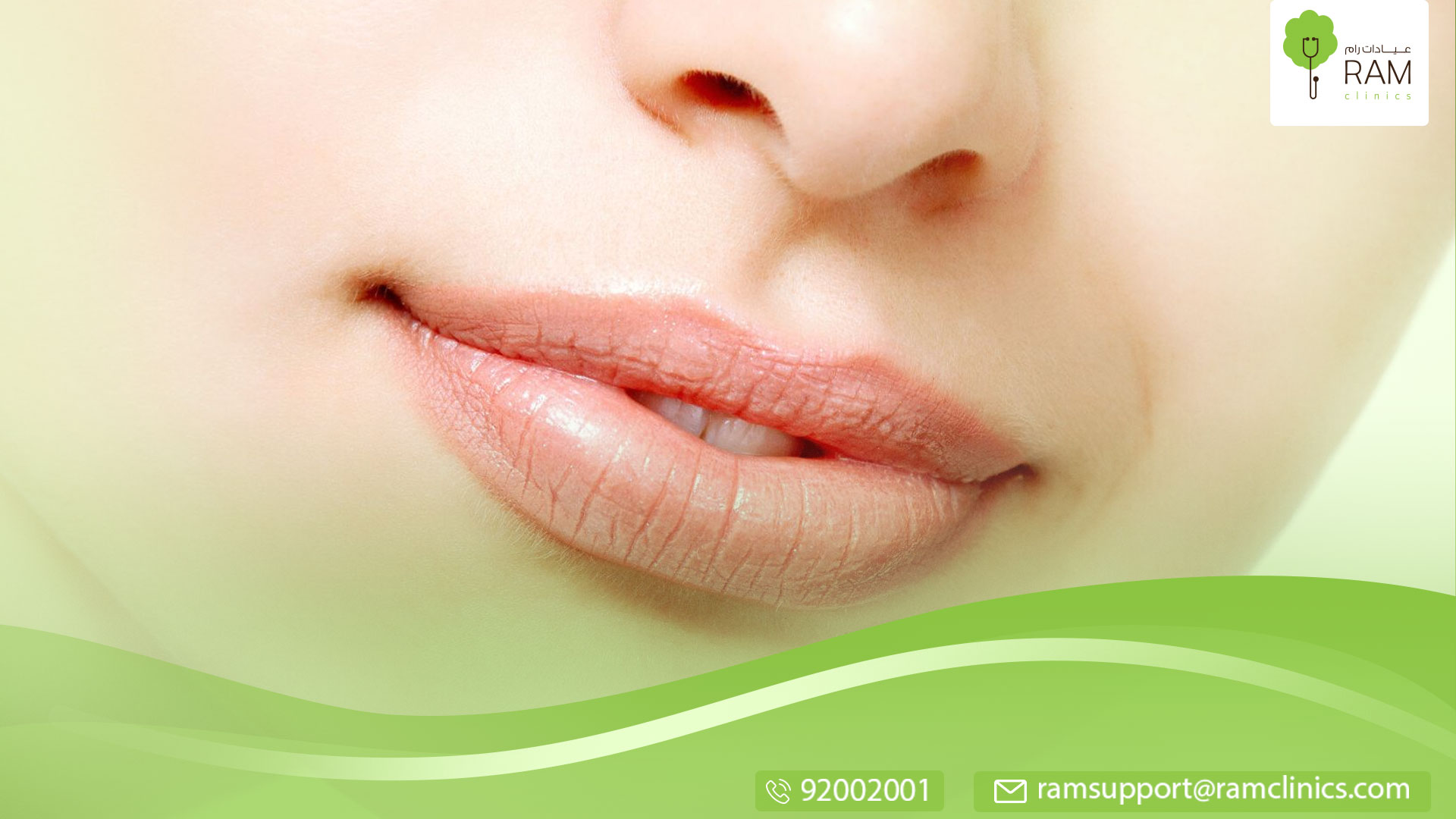 لتوريد الشفايف طبيعيًا