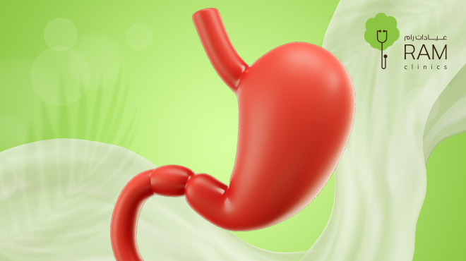 اسباب ارتجاع حمض المعدة
