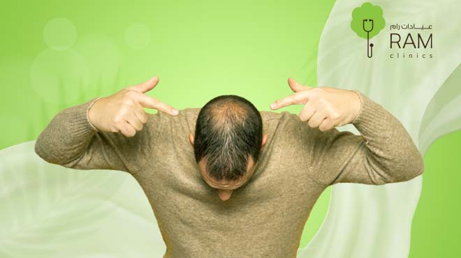 الثعلبة وطرق علاجها في عيادات رام للجلدية