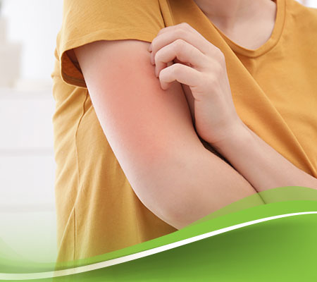 التهاب الجلد التحسسي الأعراض والأسباب