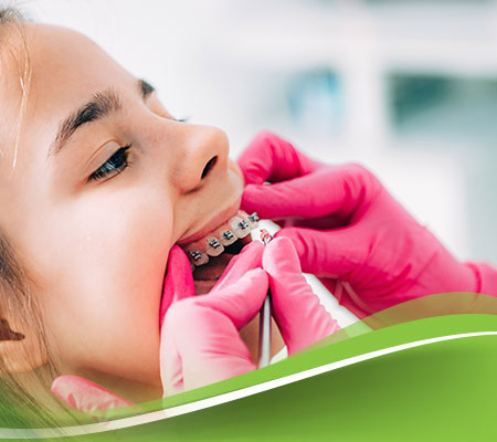 السن المناسب لتقويم الاسنان عند الاطفال