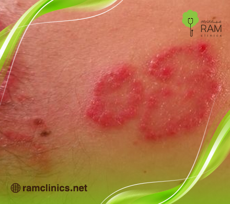 أمراض-الجلد