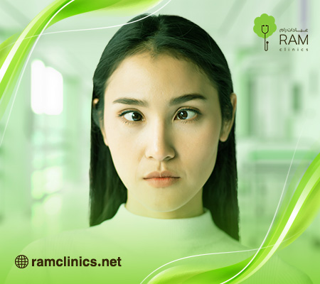 علاج-انحراف-العين