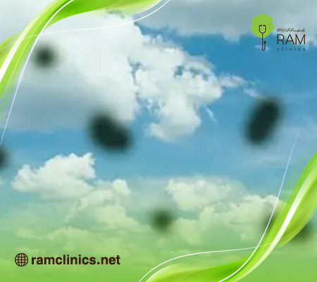 ذبابة-العين