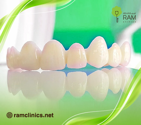 تركيبات-الزيركون-الالماني