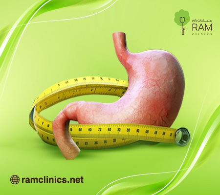 اسباب-توسع-المعده-بعد-التكميم