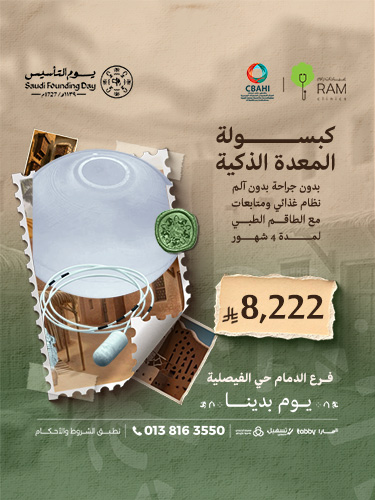 كبسولة المعدة الذكية