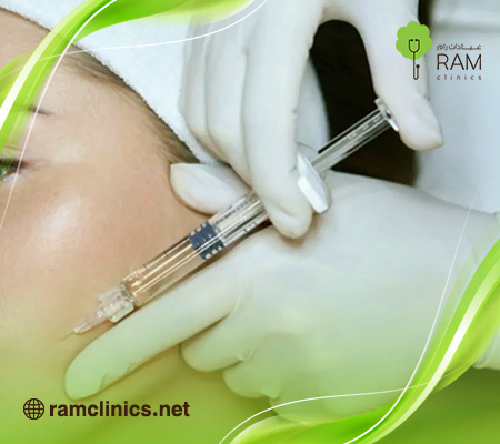 ماهي-ابرة-الجوري