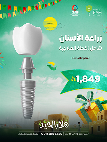 زراعة الأسنان شامل الخطة العلاجية