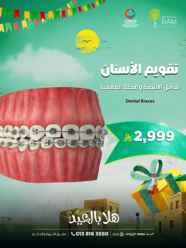 تقويم الأسنان