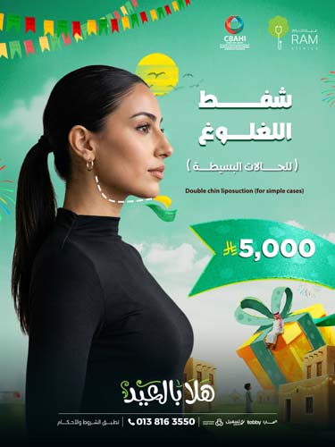 شفط اللغلوغ