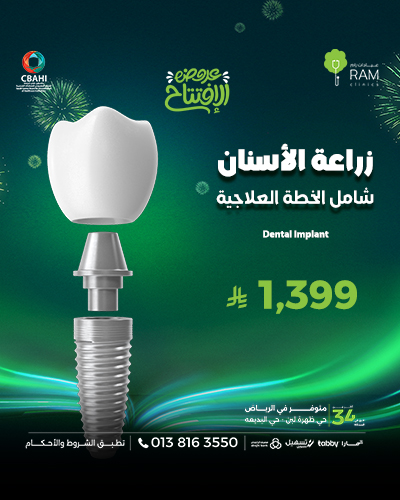 زراعة الأسنان شامل الخطة العلاجية