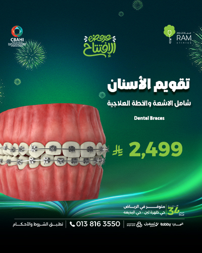 تقويم الأسنان