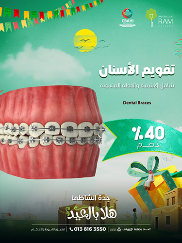 خصم 40% على تقويم الأسنان