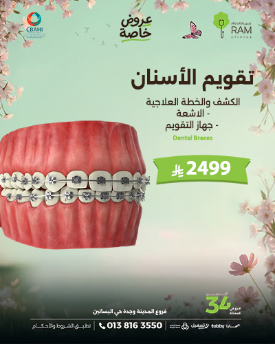 تقويم الأسنان