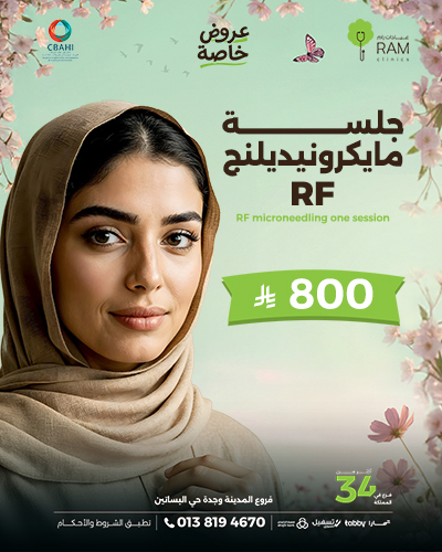RF microneedling one session