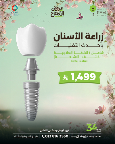 زراعة الأسنان بأحدث التقنيات