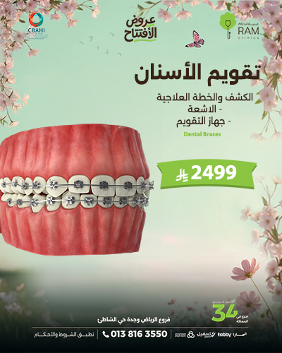 تقويم الأسنان