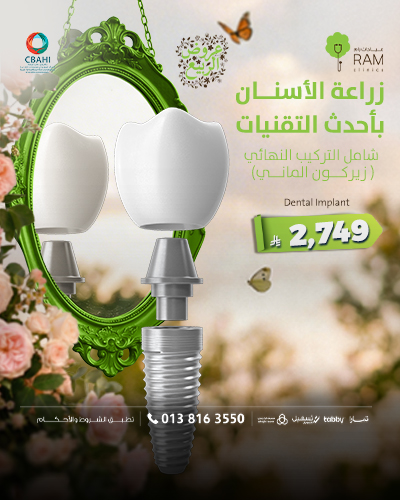 زراعة الأسنان بأحدث التقنيات