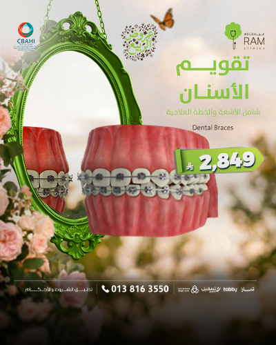 تقويم الأسنان