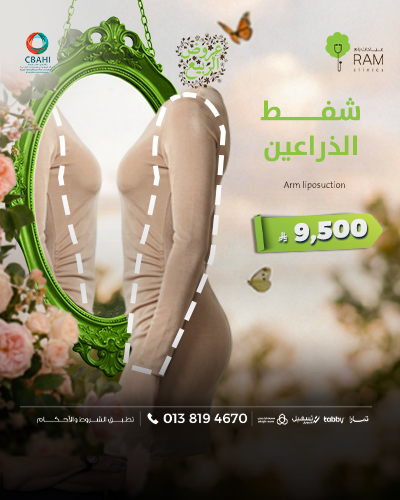 شفط الذراعين