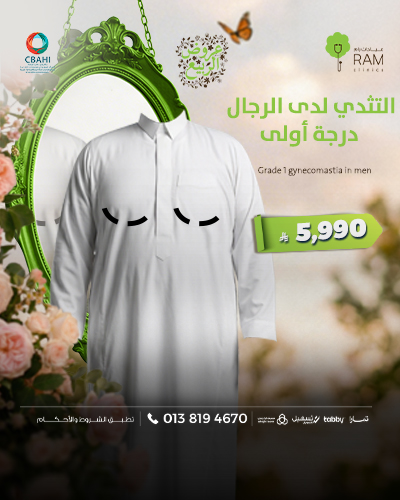 التثدي لدى الرجال