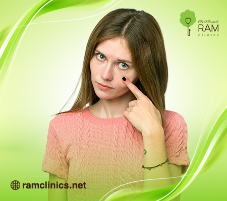 البثور-السوداء