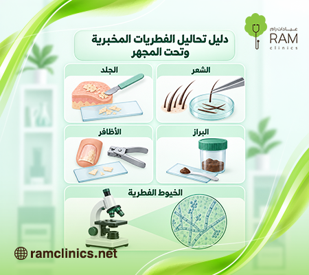اخدث طرق تشخيص الفطريات