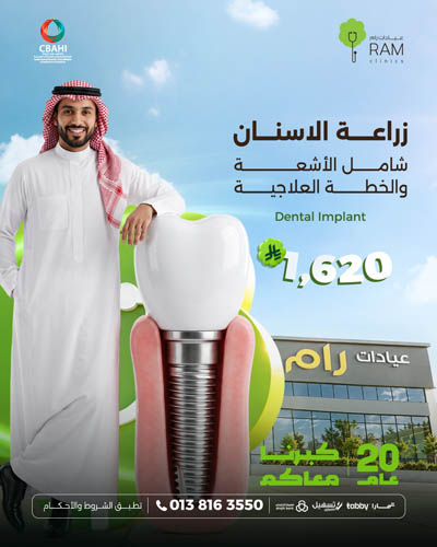 Dental Implant