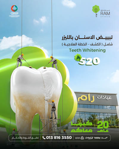 تبييض الاسنان بالليزر