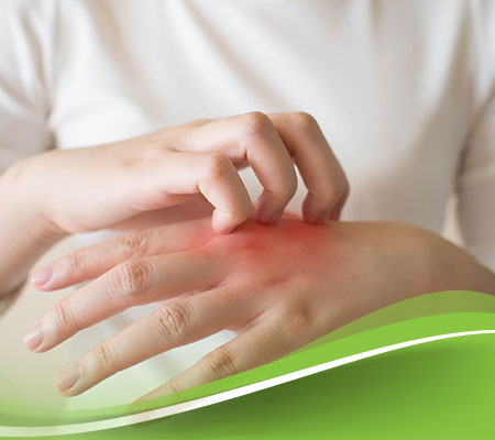 علاج التهاب الجلد التحسسي