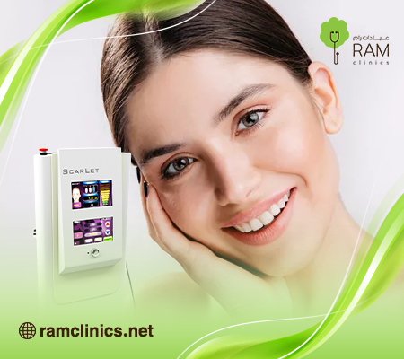 جهاز وتقنية سكارليت