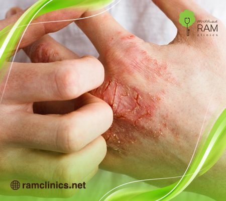 أمراض-الجلد