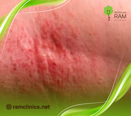 أمراض-الجلد