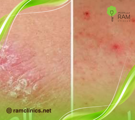 أمراض-الجلد