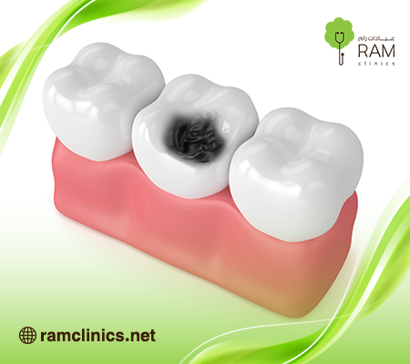 طرق-وقاية-الاسنان