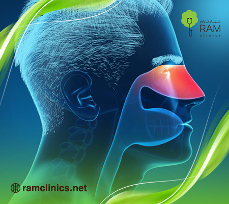 حساسية-الانف حساسية-الانف