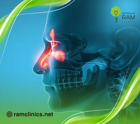 حساسية-الانف حساسية-الانف