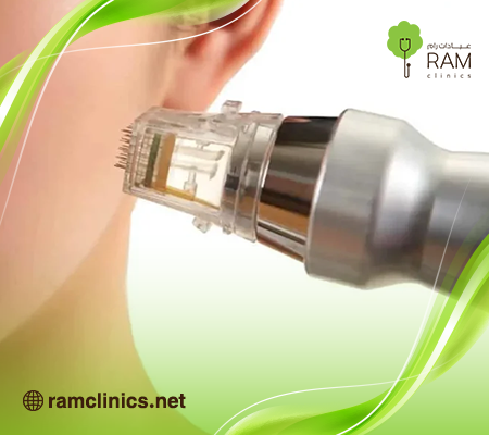 انفني-للوجه انفني-للوجه