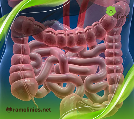 التهاب-قولون