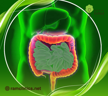 التهاب-قولون