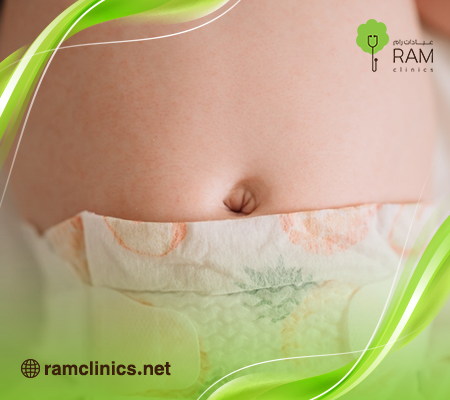 انتفاخ-بطن-الرضيع
