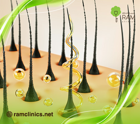 حقن-خلايا-جذعية-للشعر