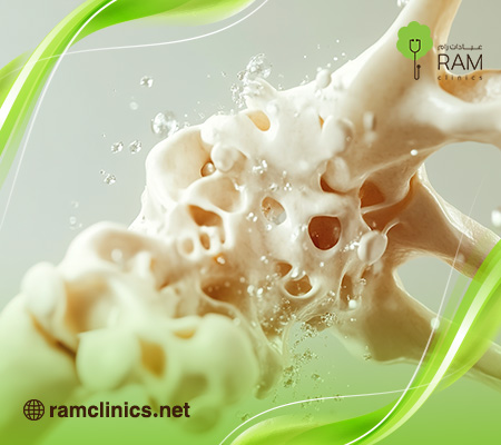 قياس-هشاشه-العظام